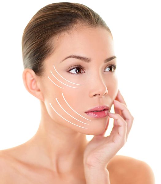 Cheek Bone Filler Lift Face