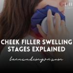 Cheek Filler Swelling Stages Explained