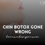 Chin Botox Gone Wrong: Understanding the Risks and Benefits