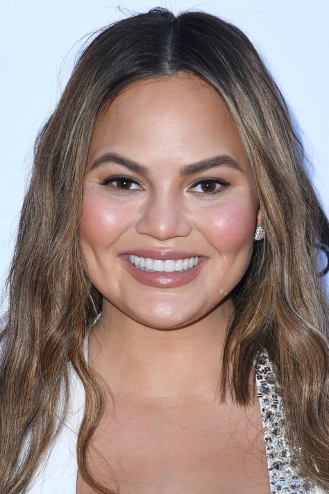 chrissy teigen fillers