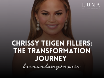 chrissy teigen fillers