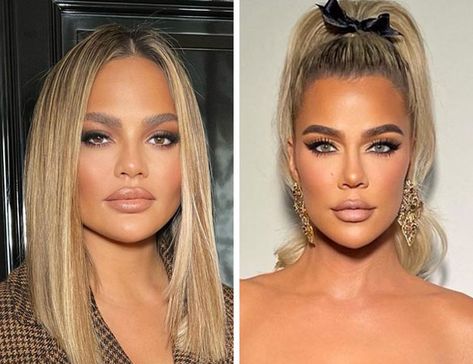 chrissy teigen fillers