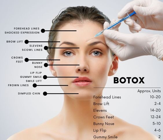 Comparison of 30G Needle Size for Filler and Botox Injection