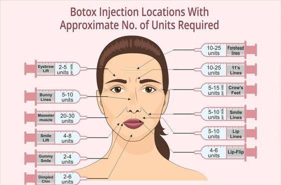 Comparison of 30G Needle Size for Filler and Botox Injection