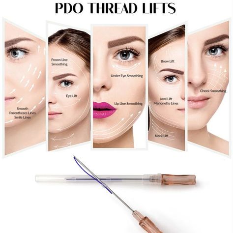 Complications of PDO Thread Lift