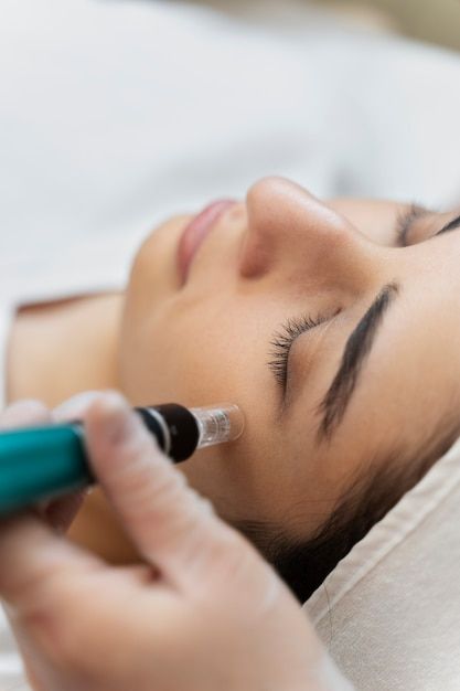 Downtime for Microneedling: What to Expect Maximize Results