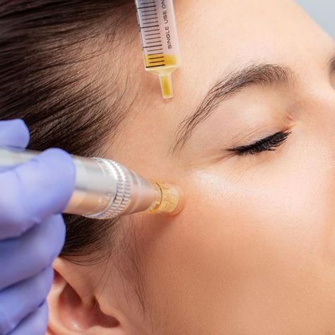 Downtime for Microneedling: What to Expect Maximize Results