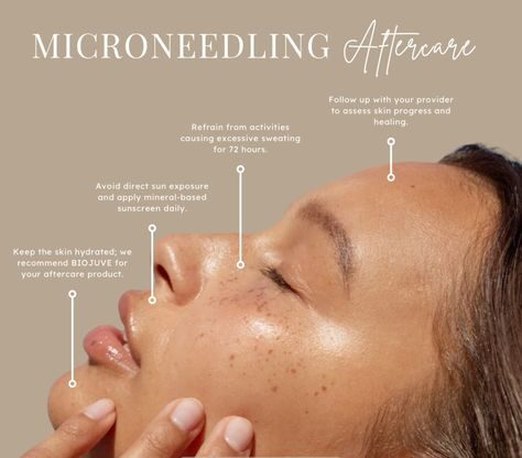 Downtime for Microneedling: What to Expect Maximize Results