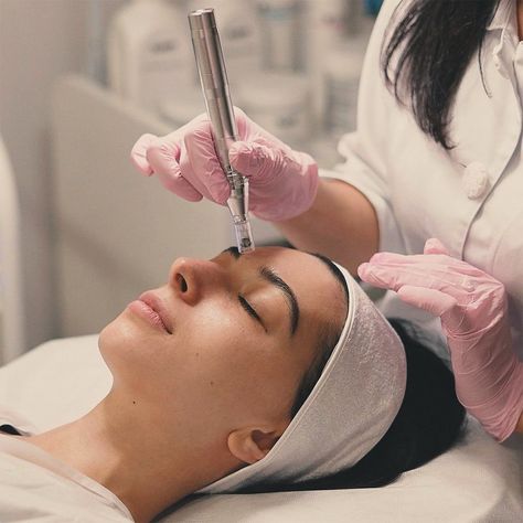 Downtime for Microneedling: What to Expect Maximize Results