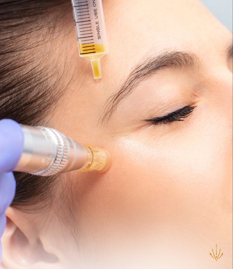 Downtime from Microneedling