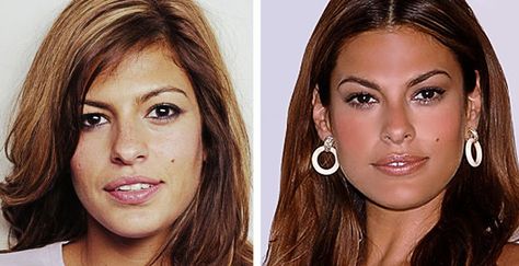 eva mendes facial surgery