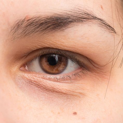 Eye Fillers Price: Understanding the Costs and Factors 