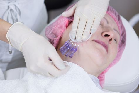 Facial Threads Gone Wrong: What You Need to Know