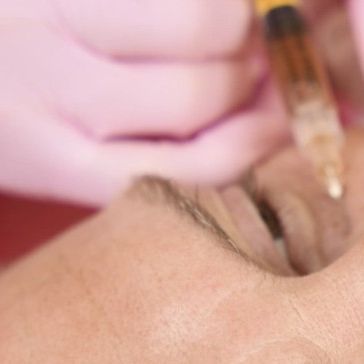 Filler Between Brows: Everything You Need to Know