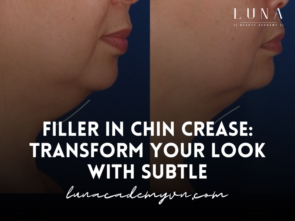 Filler in Chin Crease: Transform Your Look with Subtle