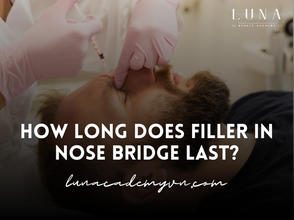 How long does filler in nose bridge last?