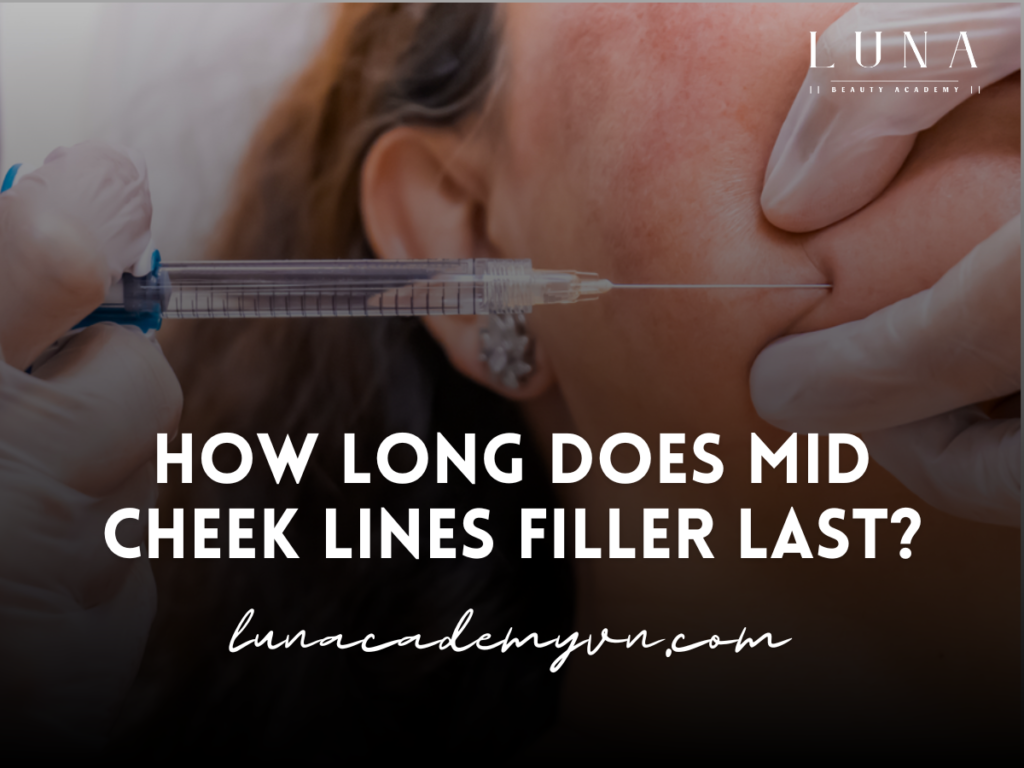 How long does mid cheek lines filler last?