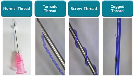 How Long Does Threading Last on Face?