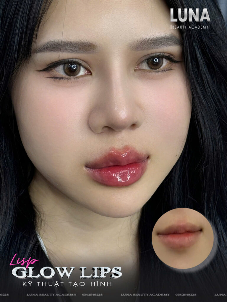 How Much is 1ml Lip Filler?