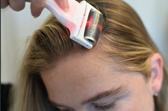 how often to derma roll scalp