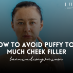 How to Avoid Puffy Too Much Cheek Filler