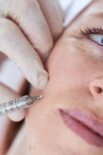 Hyaluronic Acid Fillers Before and After