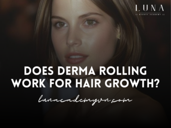 Does Derma Rolling Work for Hair Growth?