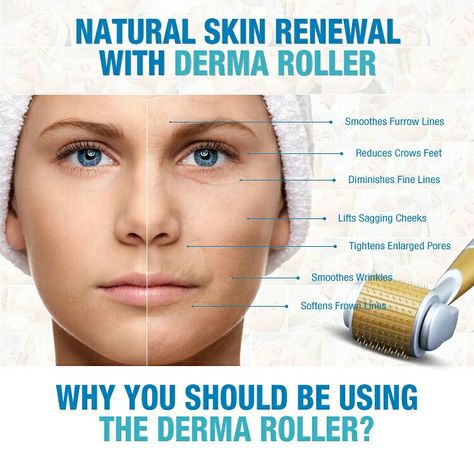 Is Derma Stamp Better Than Dermaroller?