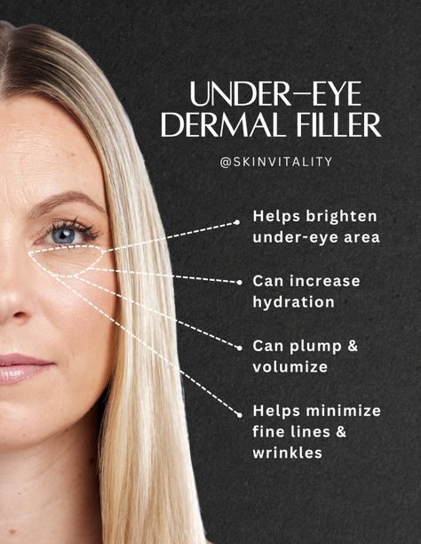 is under eye filler dangerous