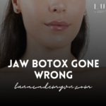 Jaw Botox Gone Wrong: What You Need to Know