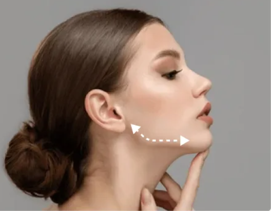 Jaw Botox Gone Wrong: What You Need to Know