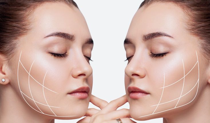 Jawline Filler Price: What You Need to Know