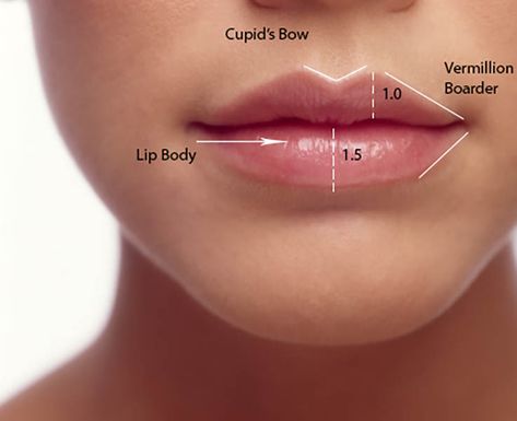 Lip Filler 2ml – You Need to Know About the Perfect Volume 