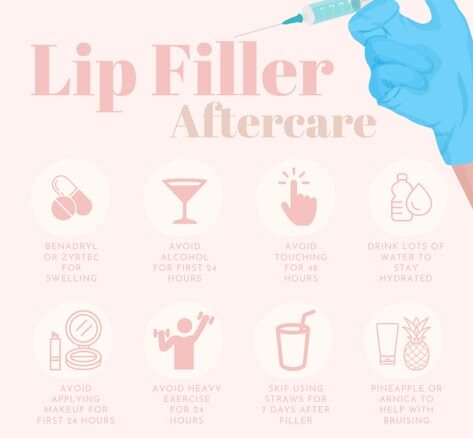 Lip Filler Dos and Don'ts