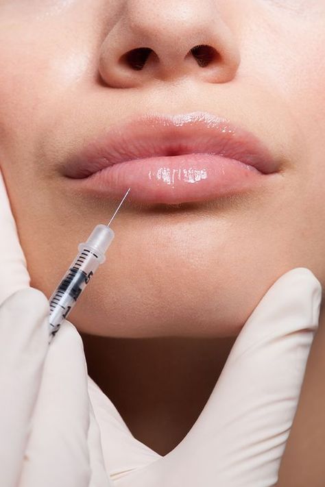 Lip Filler Dos and Don'ts