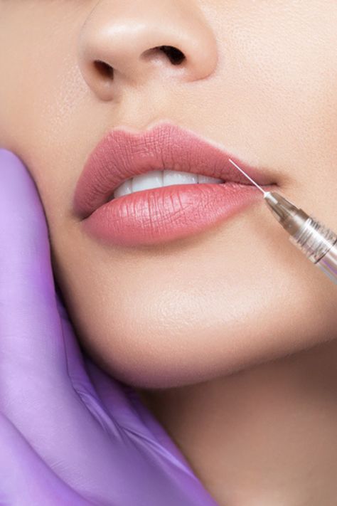 Lip Filler Dos and Don'ts