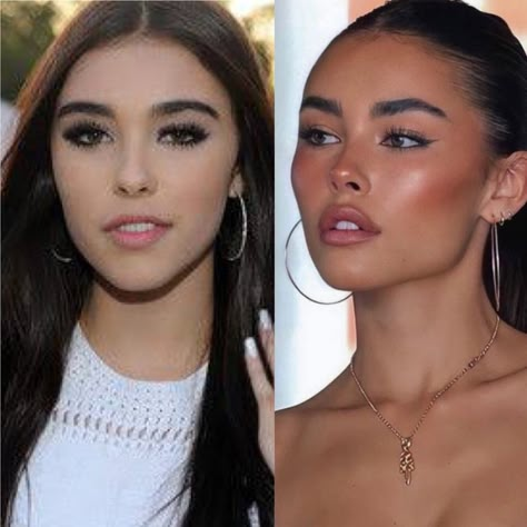 Lip Fillers Dos and Don'ts: A Comprehensive Guide