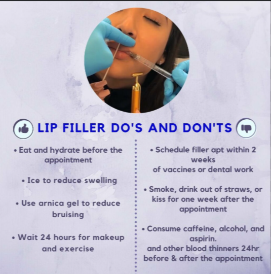 Lip Fillers Dos and Don’ts After: Post-Procedure Care