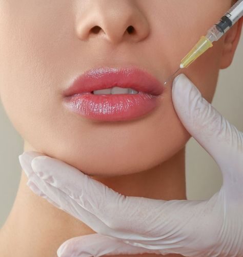 Lip Fillers Dos and Don’ts After: Post-Procedure Care