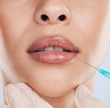 Lip Fillers Dos and Don’ts After: Post-Procedure Care