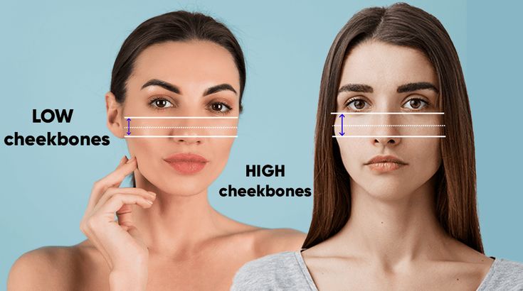 Low vs High Cheekbones