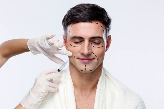 Male Jawline Filler