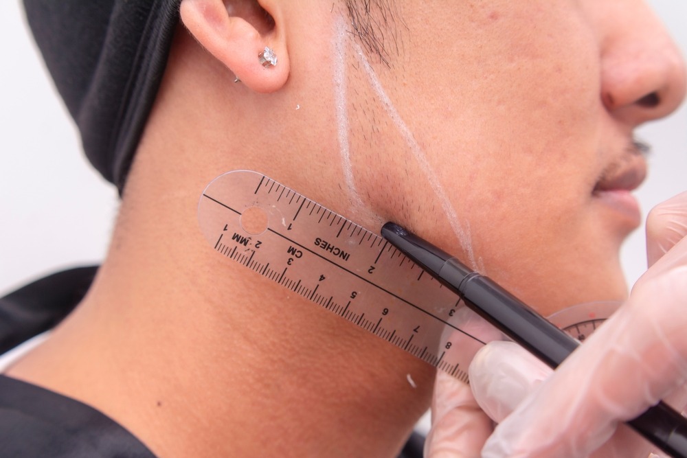 Measurements in Jawline Filler