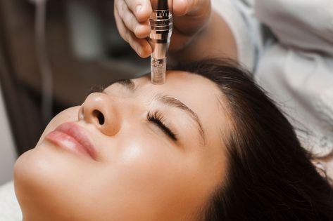 Microneedling After Hair Transplant: A Comprehensive Guide