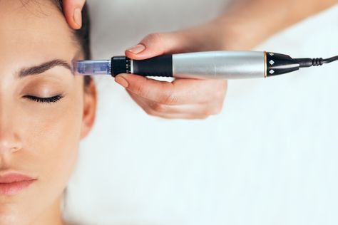 Microneedling After Hair Transplant: A Comprehensive Guide