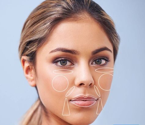 Nasolabial Fold Filler Swelling Stages