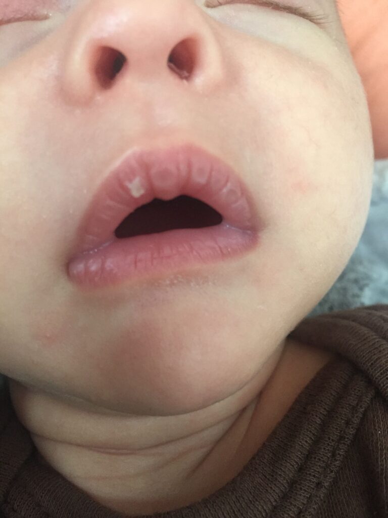 Newborn Lips to Peel