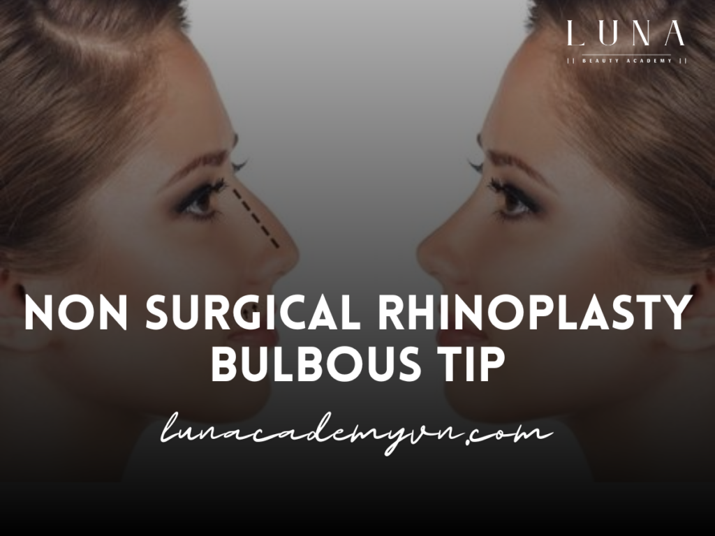 Non Surgical Rhinoplasty Bulbous Tip