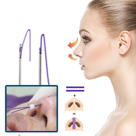 Nose Thread Lift Gone Wrong: Risks and Realities