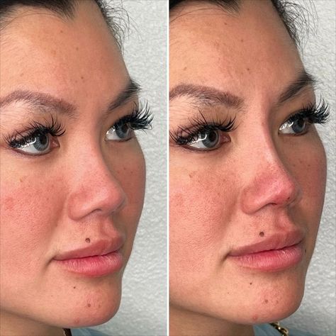 Nose Threads Before and After: Understanding the Transformation